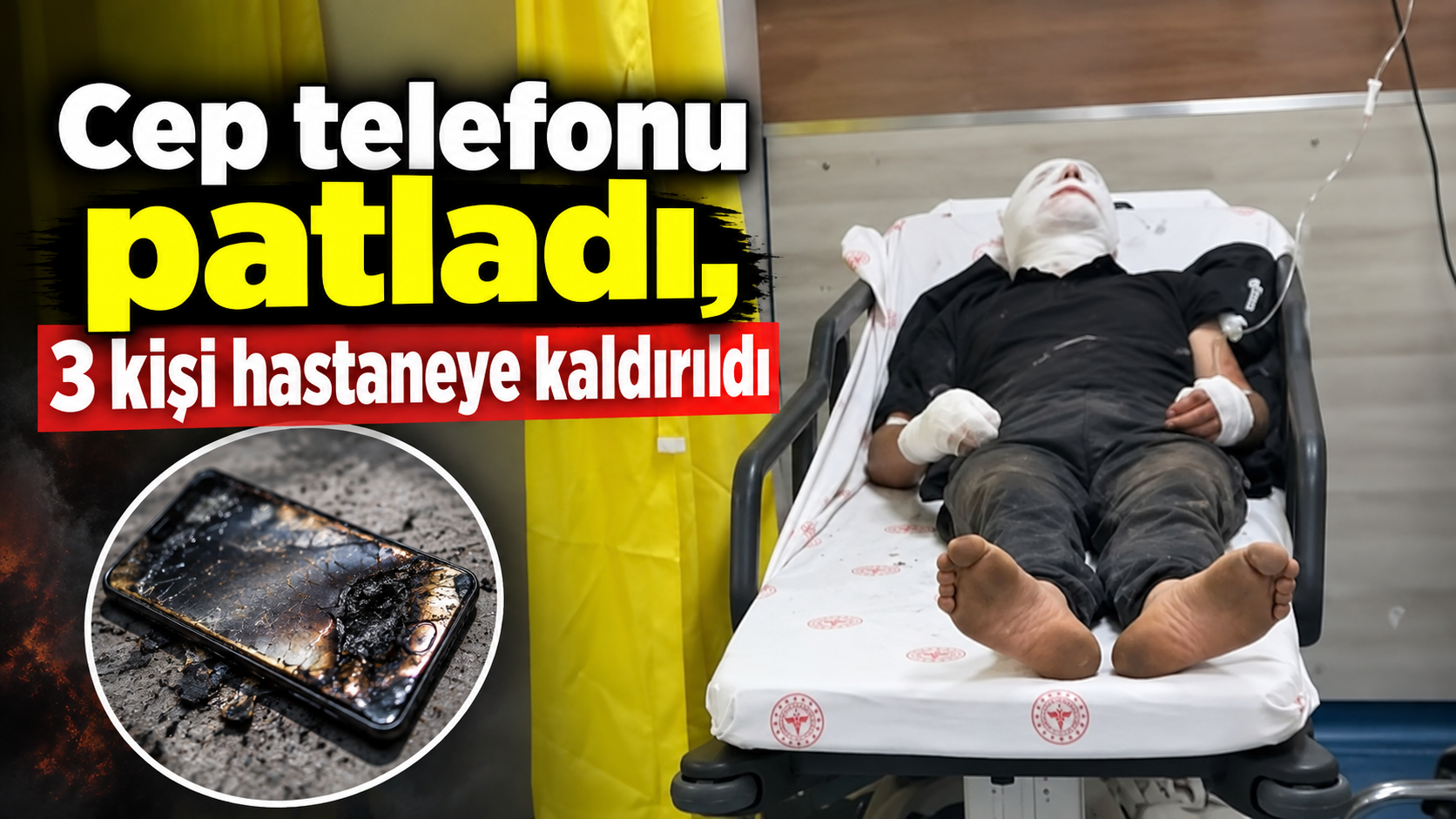 Cep telefonu patladı, 3 kişi hastaneye kaldırıldı