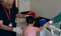 4 saat güneşte kalan çocuk hastanelik oldu
