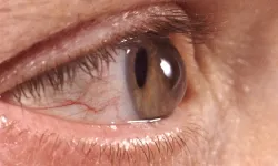 Diyarbakır Bismil'de ilk kez bu ameliyat yapıldı