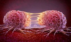 Kanser riskini artıran gıdalar: Uzmanlar uyardı