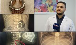 Op. Dr. Özkaya'dan çocuklarda yabancı cisim ve kimyasal madde uyarısı