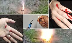 Diyarbakır'da bayramda tehlikeli oyun: Maytap patlaması yaralanmaya neden oldu