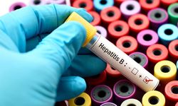 Hepatit hastaları dikkat: Yemek borusu varisi riski