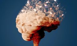 Uzmanından Alzheimer uyarısı: Erken tanı büyük önem taşıyor
