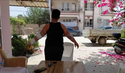 Hatay'da bir sahipsiz köpek vakası daha!