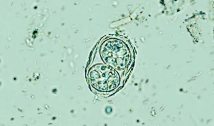 Beyindeki ‘sessiz parazit’e karşı umut verici keşif: Kapatma düğmesi bulundu