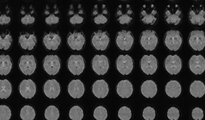 Zihin okuma artık mümkün mü? Japonlardan yeni keşif
