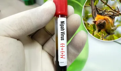 DSÖ: Nipah virüsü yüzde 75 ölüm oranına sahip; Covid-19'un 5 katı