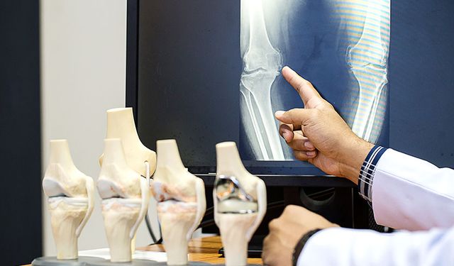 Kemik erimesine karşı alınabilecek önlemler