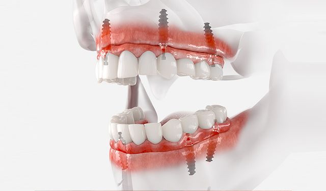 'Diş travmalarında ilk 30 dakika kritik önem taşıyor' uyarısı