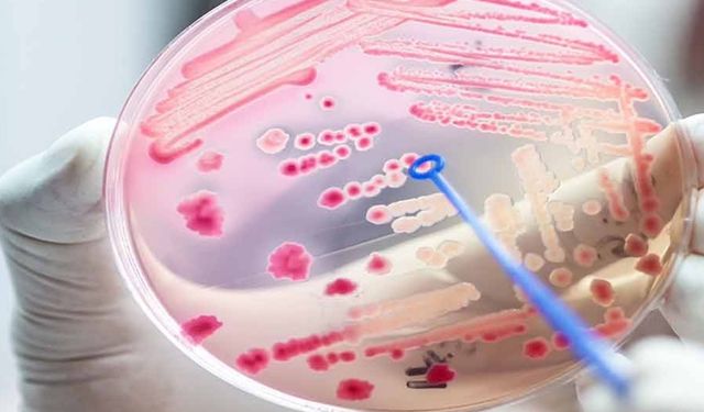 Her 3 hastadan 1’i Sepsis nedeniyle hayatını kaybediyor