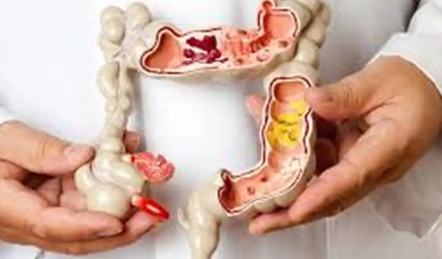 Bağırsak sağlığını güçlendiren 7 mucizevi besin!