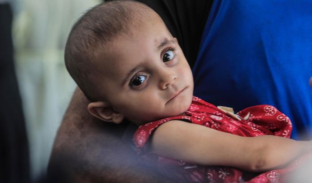 UNICEF uyardı: Gazze'de çocuklar arasında kötü beslenme oranı alarm verici seviyeye ulaştı