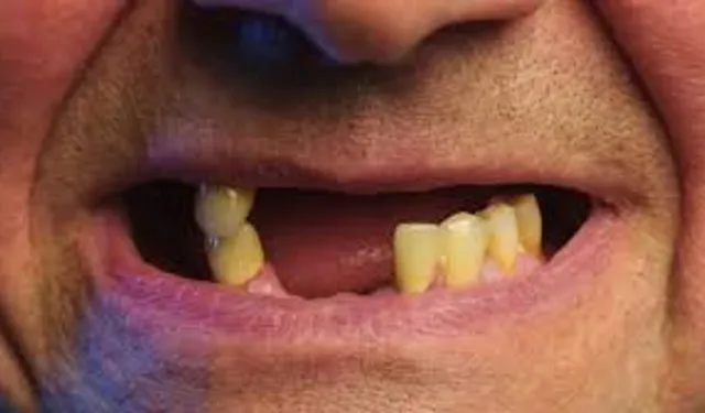 Dökülen dişleri yeniden çıkartıyor! Raflarda yer alacağı tarih belli oldu!