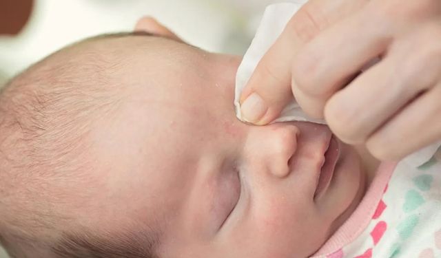 Bebek ve çocuklarda göz sulanmasına dikkat!