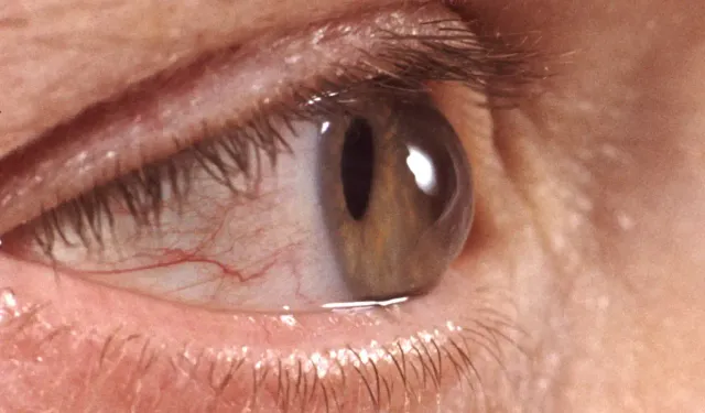 Karanlıkta telefon kullanımı göz sağlığını tehdit ediyor