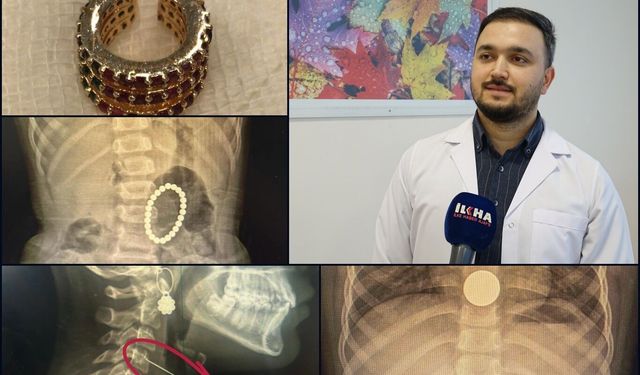 Op. Dr. Özkaya'dan çocuklarda yabancı cisim ve kimyasal madde uyarısı