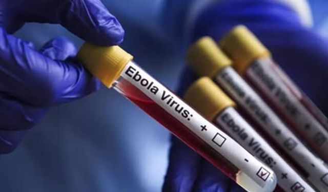 Ebola nedir? Belirtileri ve tedavi yöntemleri nelerdir?