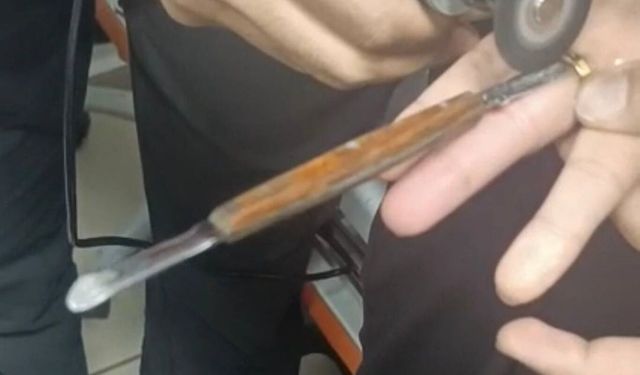 Parmağına yüzük sıkışan vatandaşın imdadına itfaiye koştu