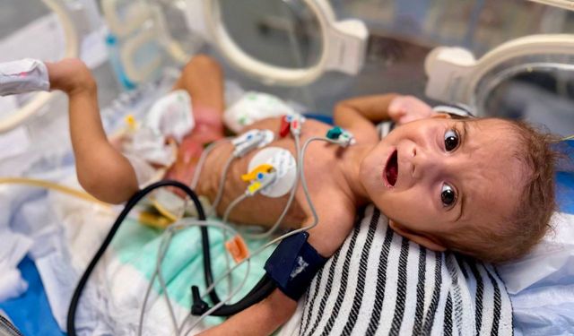 MSF: Gazze'de hastaneler çalışamaz halde