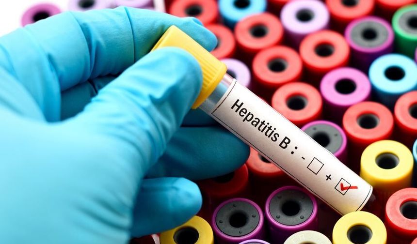 Hepatit hastaları dikkat: Yemek borusu varisi riski