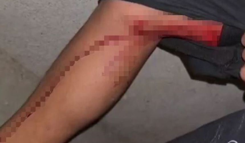 Diyarbakır'da maç kutlaması sırasında ateş açıldı: Bir çocuk yaralandı